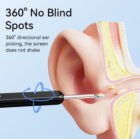 Smart Wireless Ear Cleaner with HD Camera & LED Light – Ear Wax Removal Tool for Android & iPhone